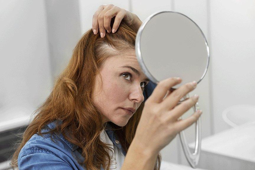 What Causes Hair Thinning? - UPSCALP